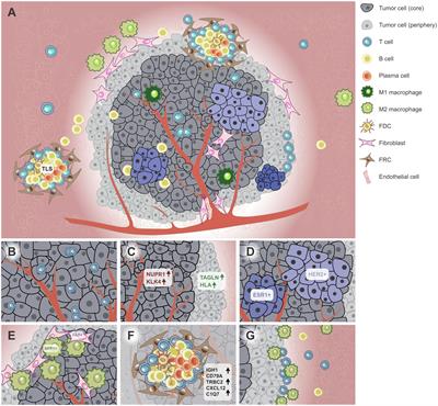 Spatial transcriptomics technology in cancer research